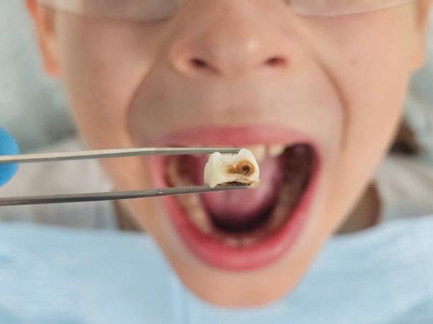 Best Dentist for Dental Trauma  in Fairview, OK